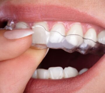 إنفزلاين (محاذات واضحة)