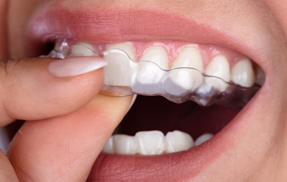 إنفزلاين (محاذات واضحة) إنفزلاين (محاذات واضحة)