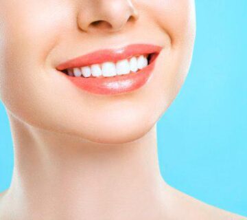 تصحيح الابتسامة (ليزر اللثة)